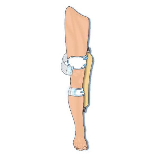 Urocare Washable Fabric Leg Bag Strap Kit - Image 3