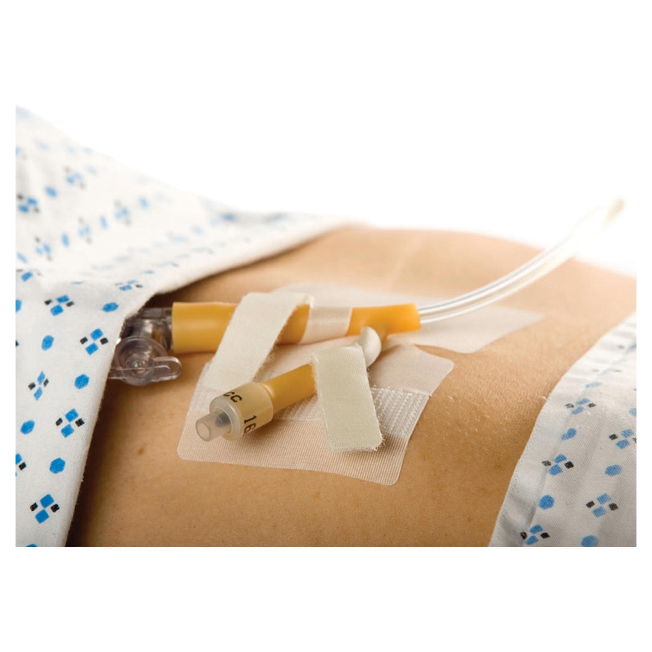 Cath-Secure Dual Tab Hypoallergenic Tube Holder - Each - Image 1