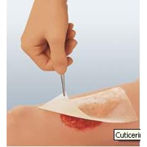 Smith & Nephew Cuticerin Oil Emulsion Impregnated Dressing - Image 3