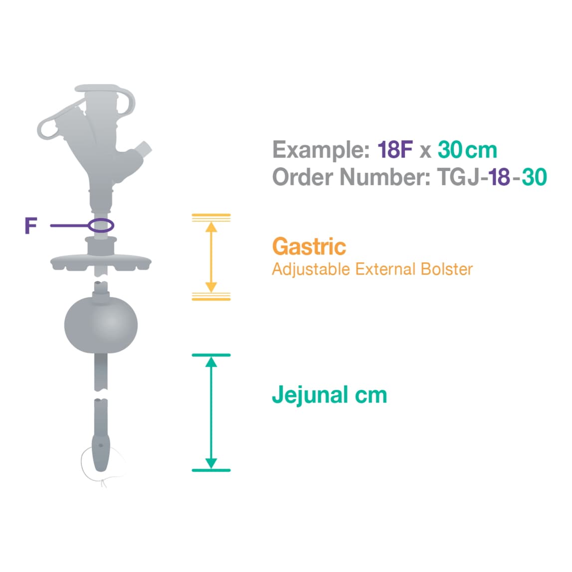 AMT Traditional G-JET Enfit Gastric Jejunal Feeding Tube Kit - Image 2