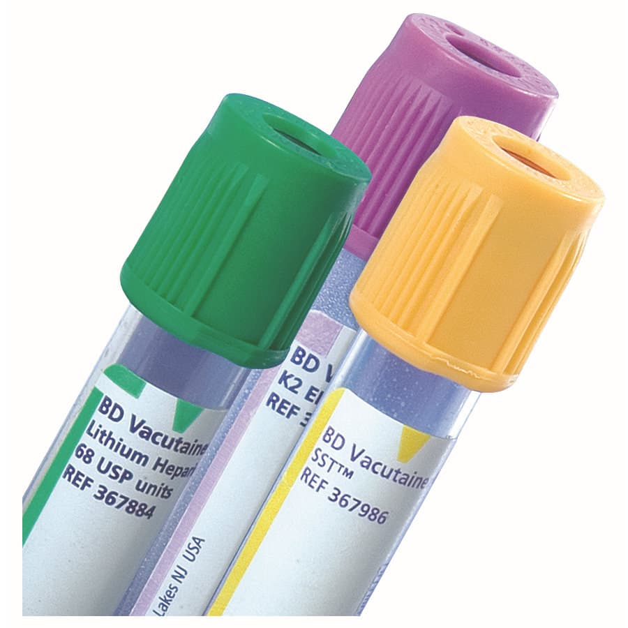 BD Vacutainer SST Venous Blood Collection Serum Tube, 10 ML - Case of 1000 - Image 1