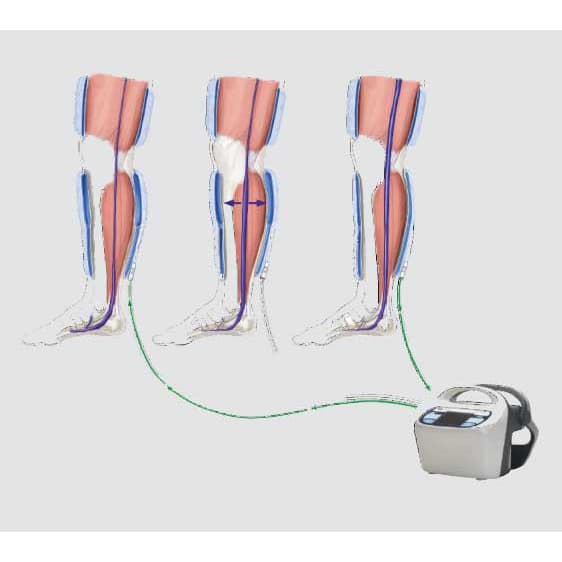 Covidien SCD Express Sleeves - Image 3