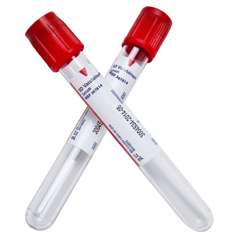 BD Vacutainer Venous Blood Collection Silicone Coated Tube - Image 1