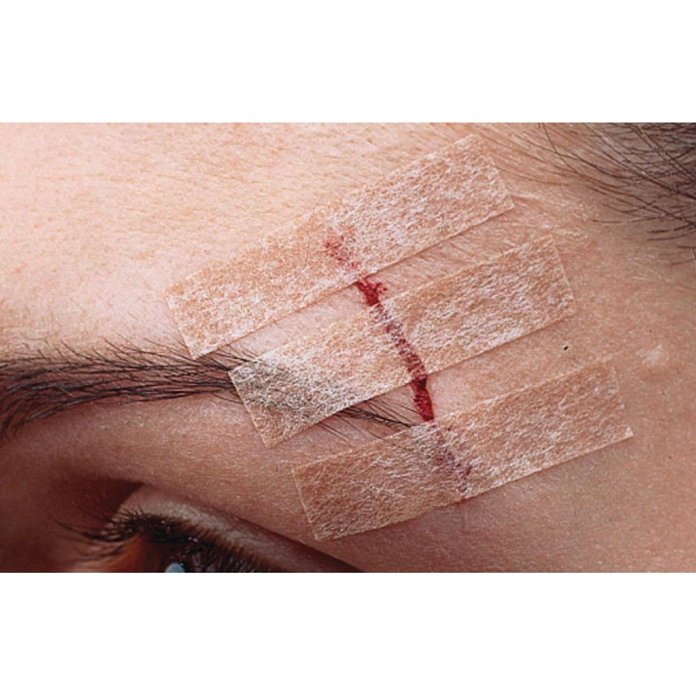 3M Steri-Strip Blend Tone Skin Closure Strip, Tan - Image 2