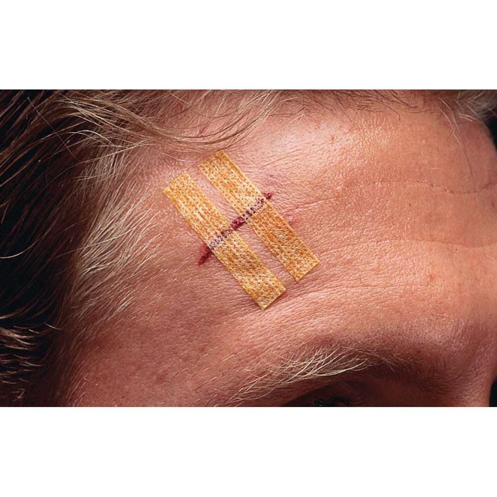 3M Steri-Strip Antimicrobial Skin Closures - Image 2