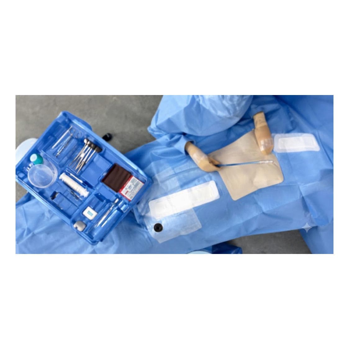 Cardinal Health Obstetrics and Gynecology Drape Pack Peri-Gyn Pack with Adhesive Drape - Case of 10 - Image 1