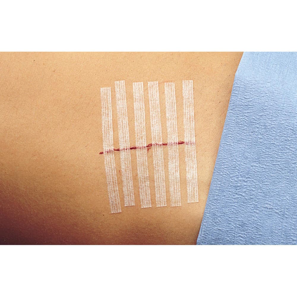3M Steri-Strip Skin Closure Strip, Nonwoven Material Reinforced Strip - Image 2