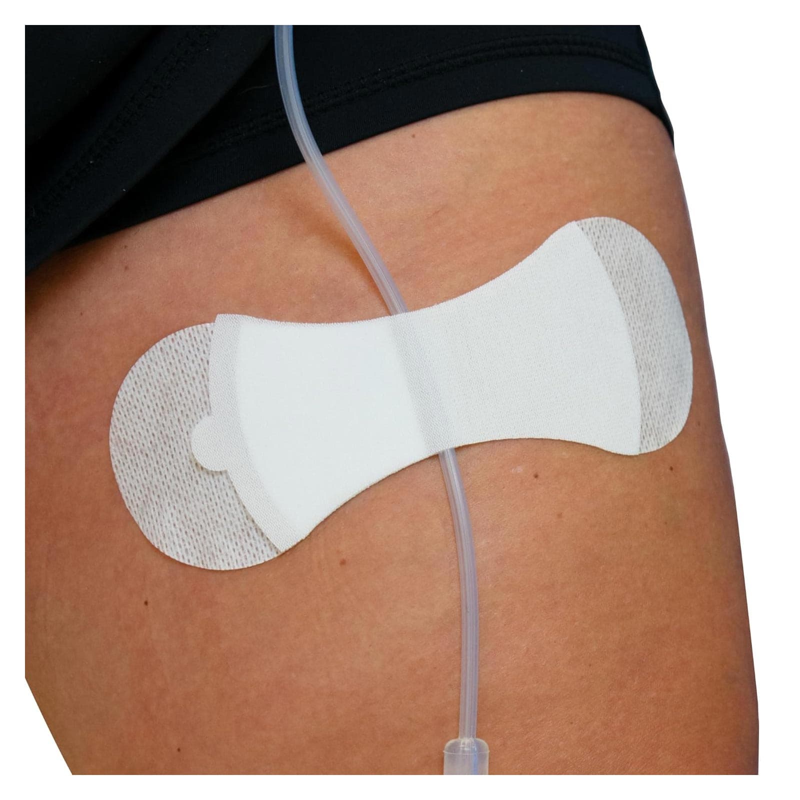 Grip-Lok General Securement Device for Universal Catheter, Large - Box of 100 - Image 1