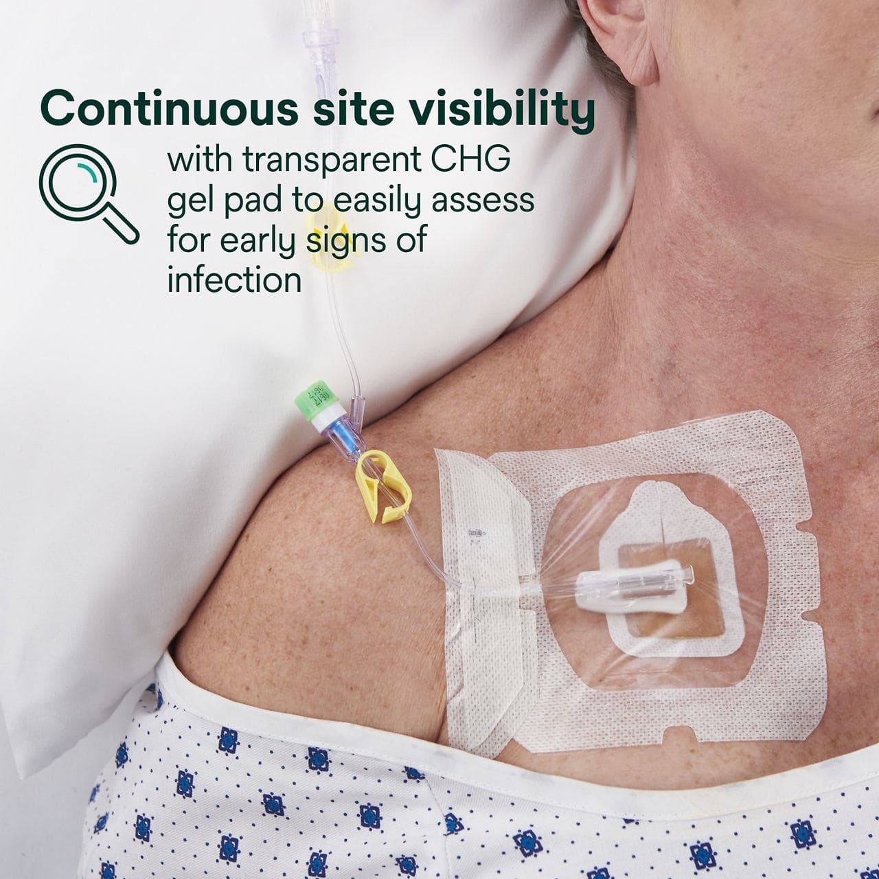 3M Tegaderm CHG Chlorhexidine Gluconate I.V. Port Dressing - Image 5