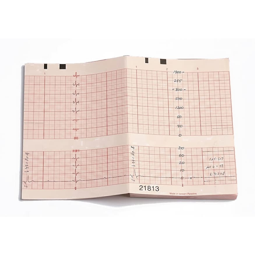 Precision Charts Z-Fold Fetal Red Grid Monitoring Chart Paper, 5.9" x 49' - Package of 150 - Image 1