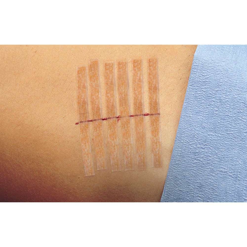 3M Steri-Strip Antimicrobial Skin Closures - Image 3