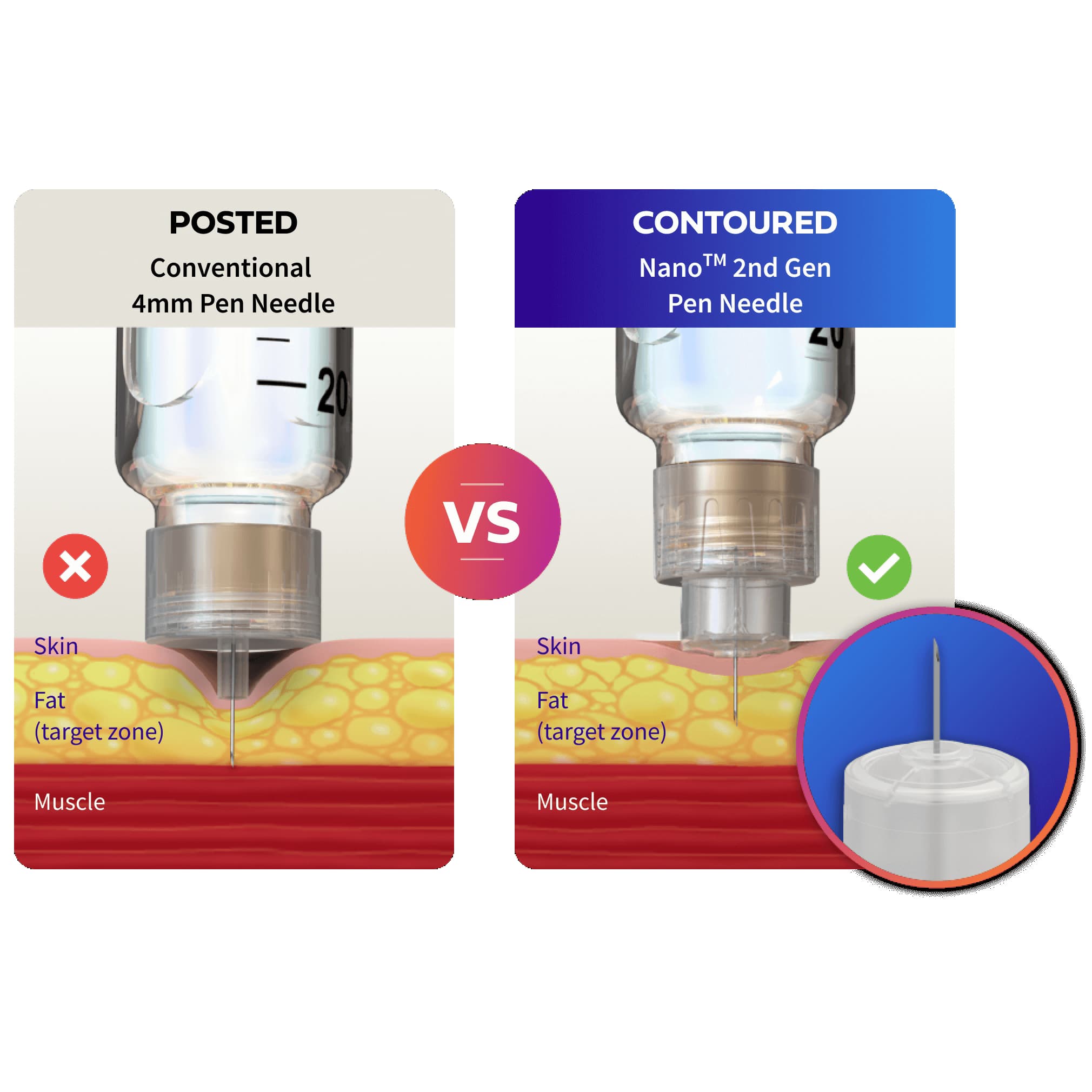 Embecta Nano 2nd Gen Standard Insulin Pen Needle, 32 Gauge, 4 mm - Image 3