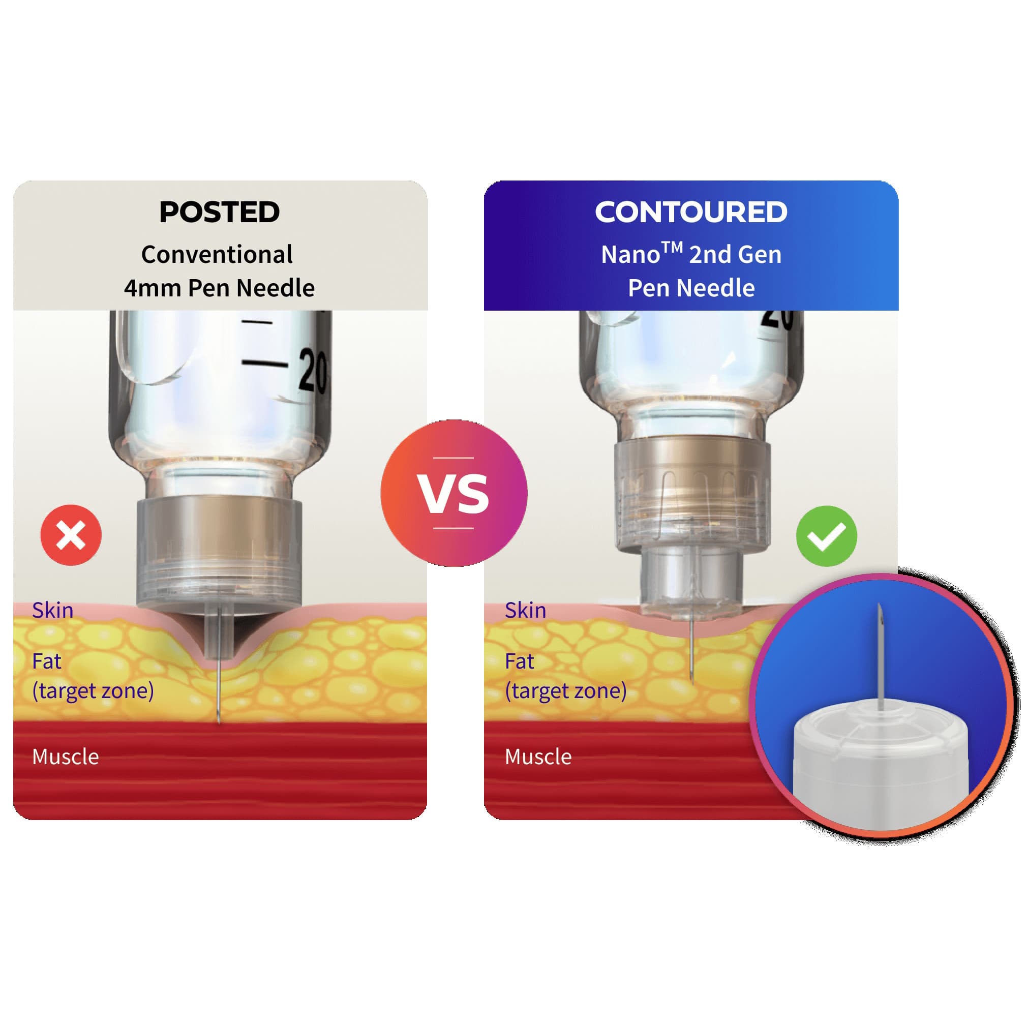 Embecta Nano 2nd Gen Standard Insulin Pen Needle, 32 Gauge, 4 mm - Image 6