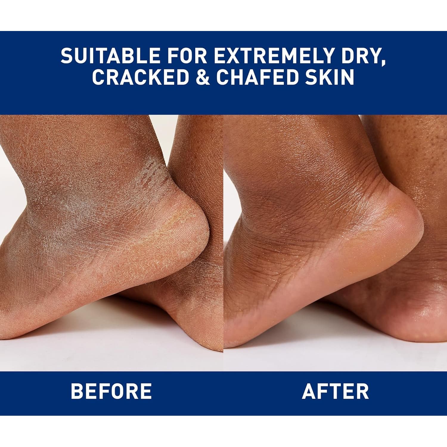 CeraVe Healing Ointment, Hydrating Skin Protectant, Unscented - Image 4