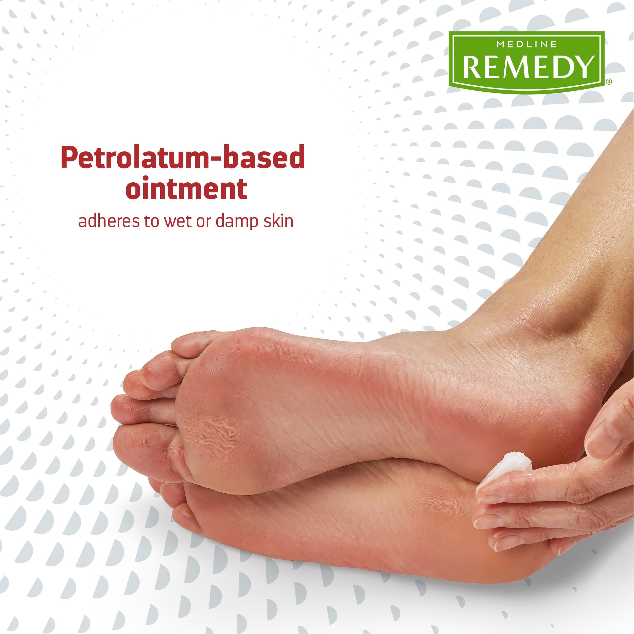 Remedy Clinical Antifungal Ointment, 2.5 oz - Image 7