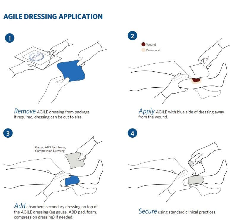 Milliken Agile Fibril Dressing with AFM Technology - Image 3