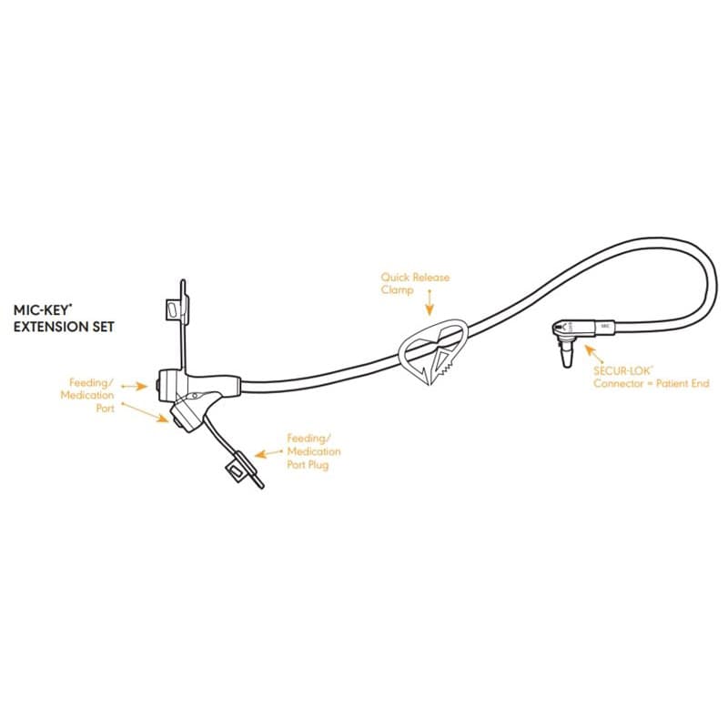 Mic-Key Low-Profile Gastrostomy Feeding Tube Kit, Non-Enfit - Image 5