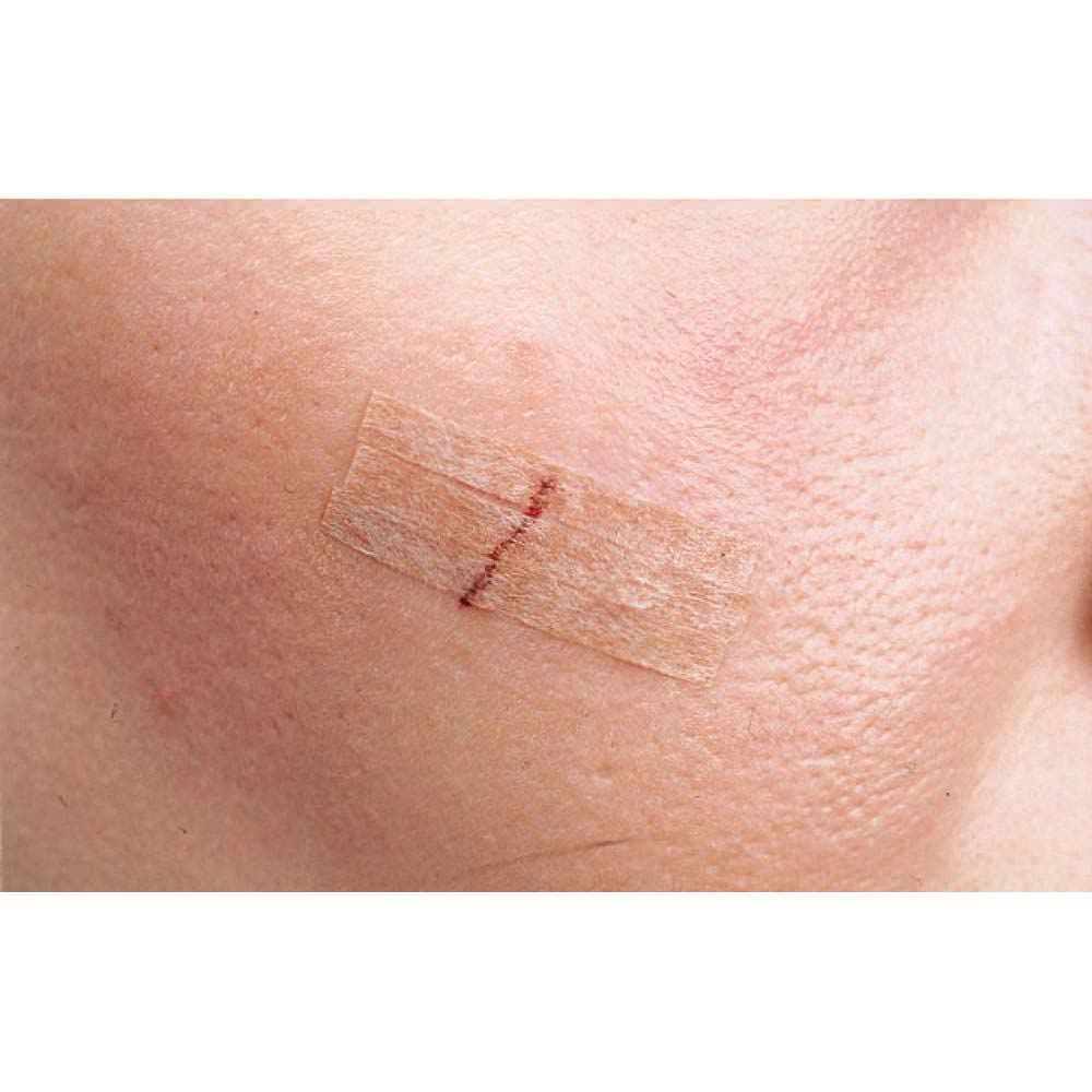 3M Steri-Strip Blend Tone Skin Closure Strip, Tan - Image 3