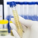 Urinalysis Tubes | Accurate Sample Collection and Testing