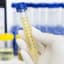Urinalysis Tubes | Accurate Sample Collection and Testing